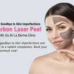 Carbon Facial