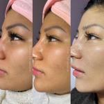 BB Glow Facial